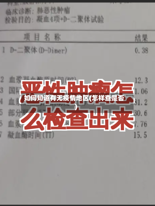 如何知道有无疫情地区(怎样查是否)