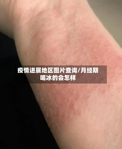 疫情进展地区图片查询/月经期喝冰的会怎样