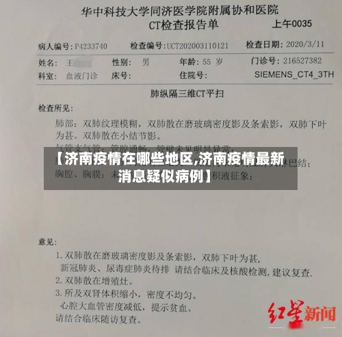 【济南疫情在哪些地区,济南疫情最新消息疑似病例】-第2张图片
