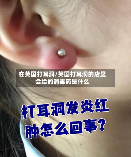 在英国打耳洞/英国打耳洞的店里会给的消毒药是什么-第2张图片