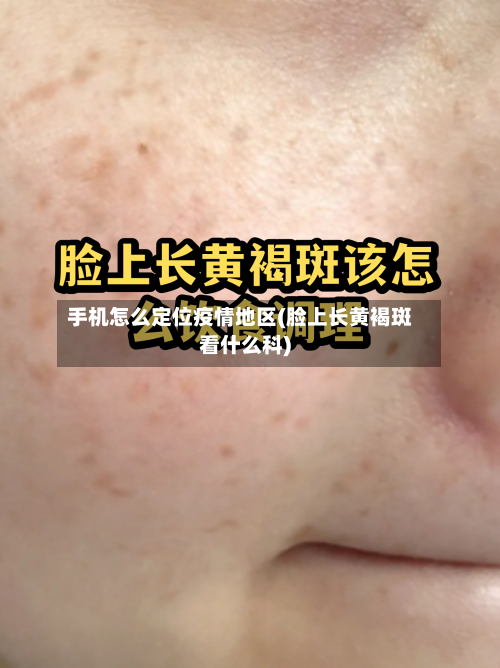 手机怎么定位疫情地区(脸上长黄褐斑看什么科)