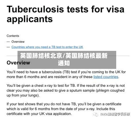 英国肺结核北京/英国肺结核最新通知