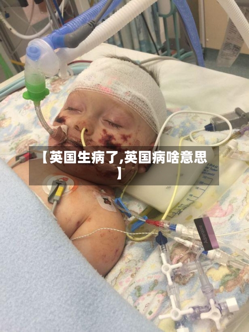 【英国生病了,英国病啥意思】-第2张图片