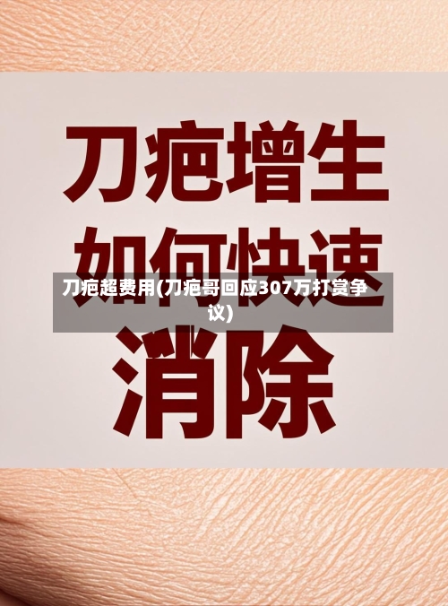 刀疤超费用(刀疤哥回应307万打赏争议)